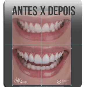 Antes x Depois